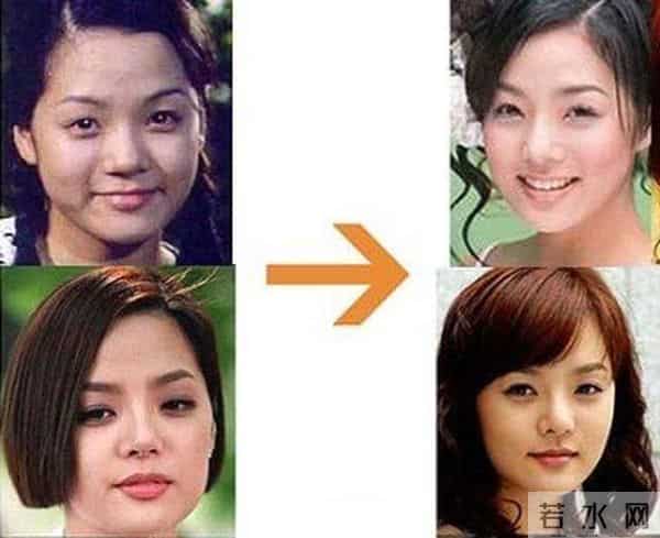 整容后遗症有多可怕?当年在中国爆红的韩星,现在都认不出来了