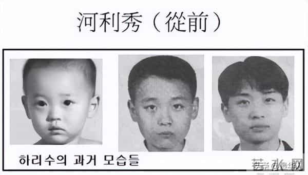 最美变性人河莉秀：被丈夫抛弃，后遗症明显，身体不如80岁老太太