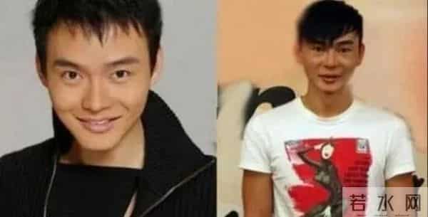 整容变“毁容”，面容僵硬成蜡像，这些男星咋就想不开要去动脸呢