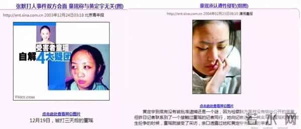 明星家暴：身体只是小伤，心灵受到的伤更难愈合