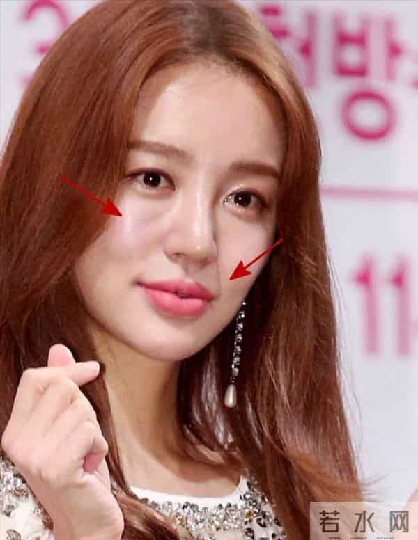 整容后遗症有多可怕?当年在中国爆红的韩星,现在都认不出来了