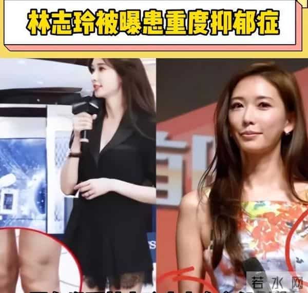 面相大变!嫁日6年,林志玲近况曝光,脸僵嘴凸,彻底日化难回头