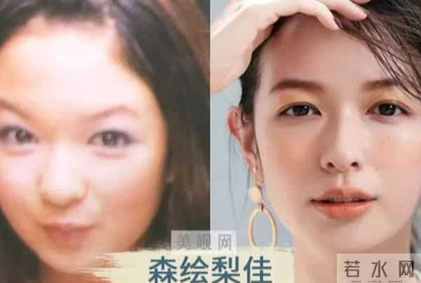 日本才是真正的“整形大国”！能年玲奈的换头大法了解一下