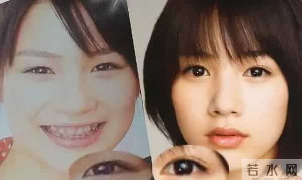 日本才是真正的“整形大国”！能年玲奈的换头大法了解一下