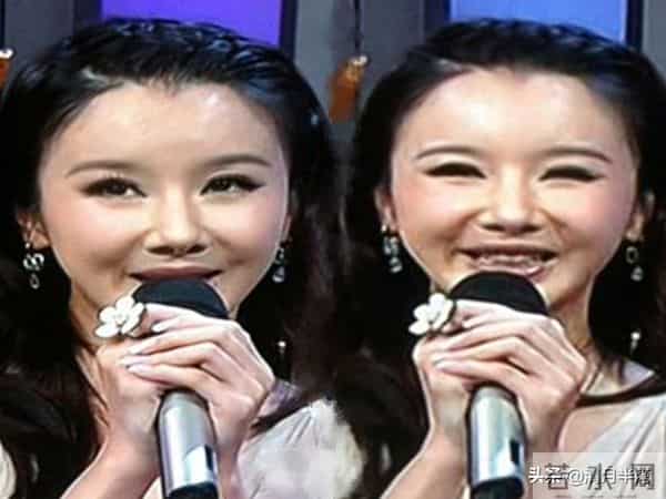 明明已经美得不可一世,却想不开去动脸,这4位女星全是反面案例