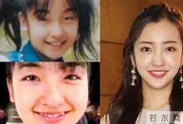 日本才是真正的“整形大国”！能年玲奈的换头大法了解一下