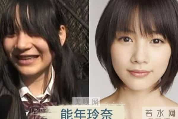 日本才是真正的“整形大国”！能年玲奈的换头大法了解一下