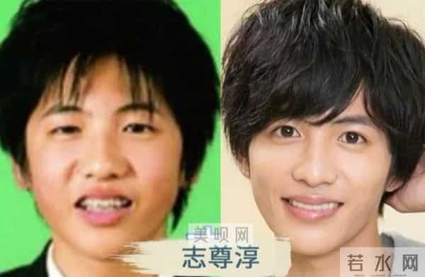 日本才是真正的“整形大国”！能年玲奈的换头大法了解一下