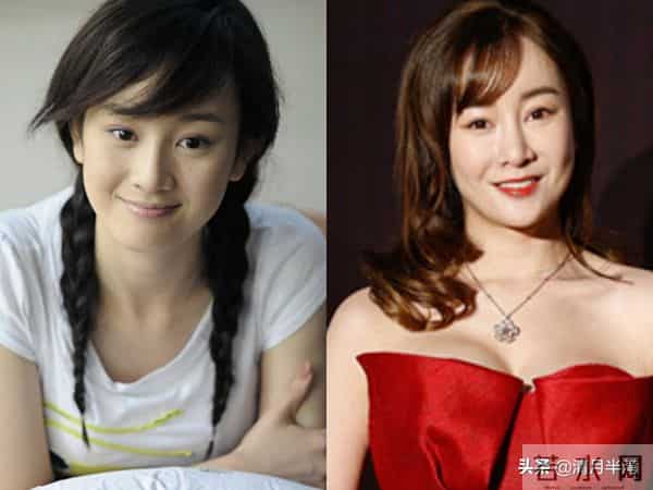 明明已经美得不可一世,却想不开去动脸,这4位女星全是反面案例