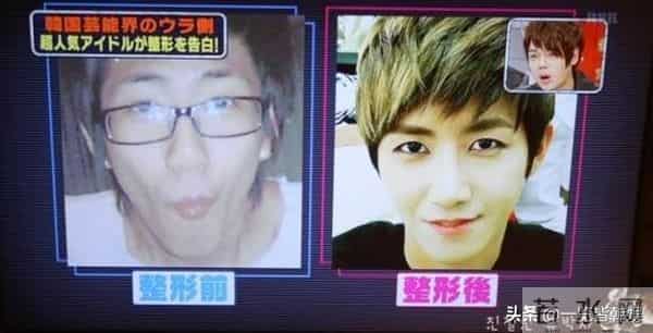 黄光熙公开整容苦衷 狂怼李孝利艺能感爆棚 自嘲不怕被骂超心酸