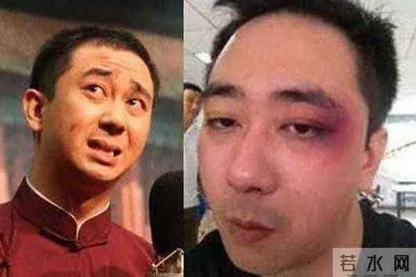 明星家暴：身体只是小伤，心灵受到的伤更难愈合