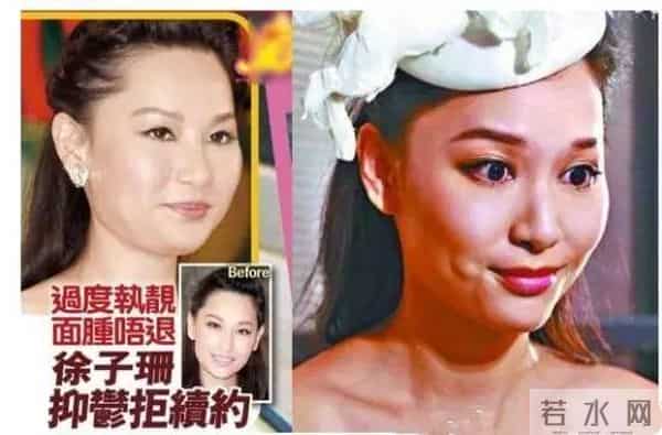 她是TVB超强招黑体质，曾经是张馨予情敌，如今即将进军内地？