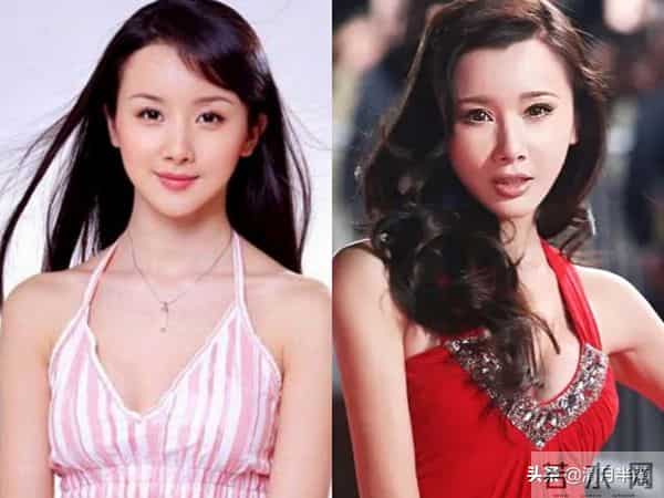 明明已经美得不可一世,却想不开去动脸,这4位女星全是反面案例