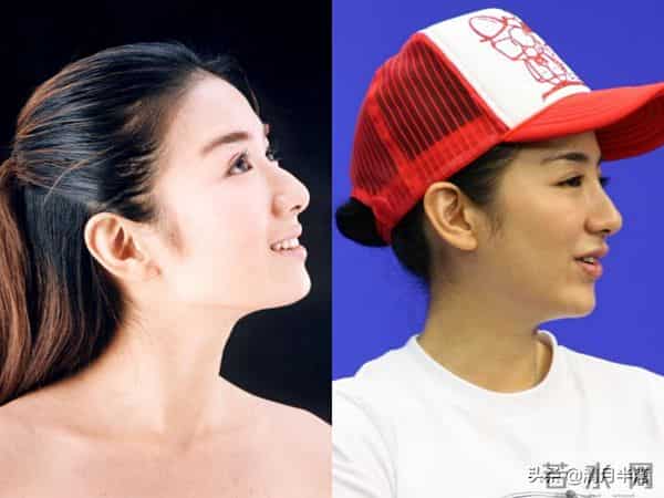 明明已经美得不可一世,却想不开去动脸,这4位女星全是反面案例