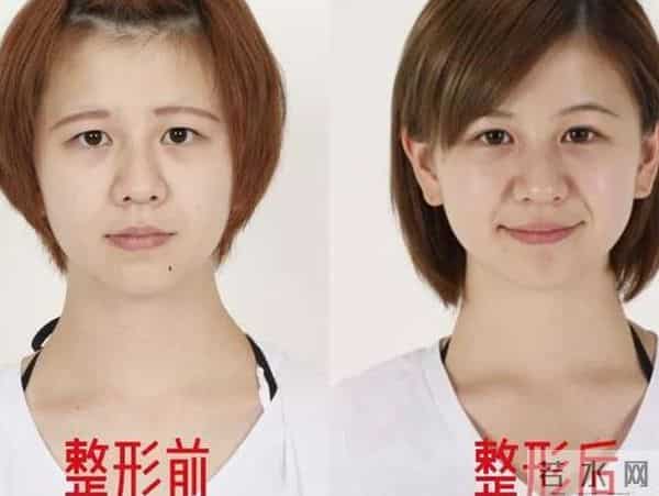 日本才是真正的“整形大国”！能年玲奈的换头大法了解一下