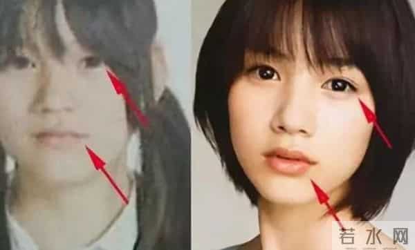 日本才是真正的“整形大国”！能年玲奈的换头大法了解一下