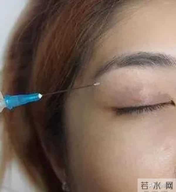 顶级豪门孙女赴韩吸脂隆胸后死亡，这是选了什么破野鸡医院啊