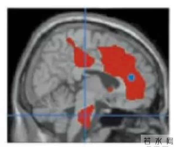 这个止痛方法，是要靠嘴说的