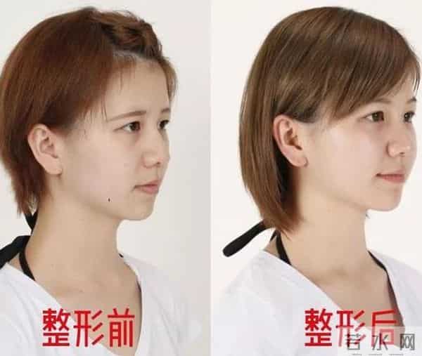 日本才是真正的“整形大国”！能年玲奈的换头大法了解一下