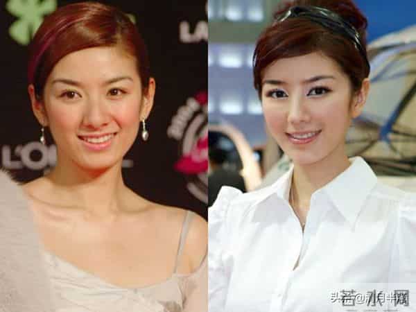 明明已经美得不可一世,却想不开去动脸,这4位女星全是反面案例