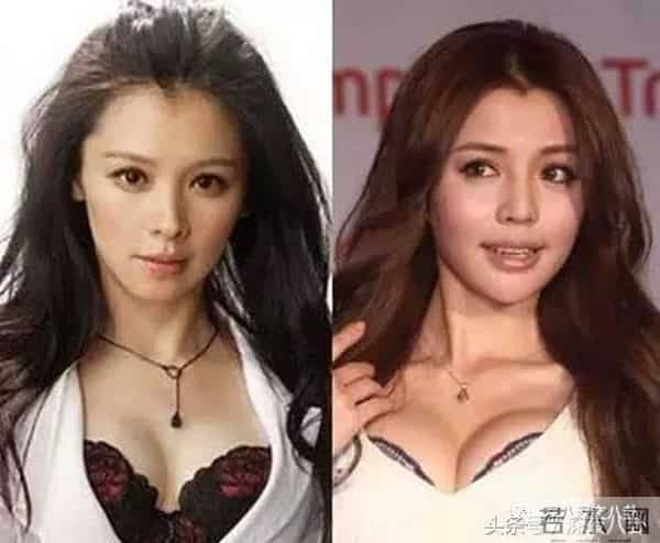 罗志祥、房祖名、柯震东一个都没逃整容脸李毓芬捆绑炒作