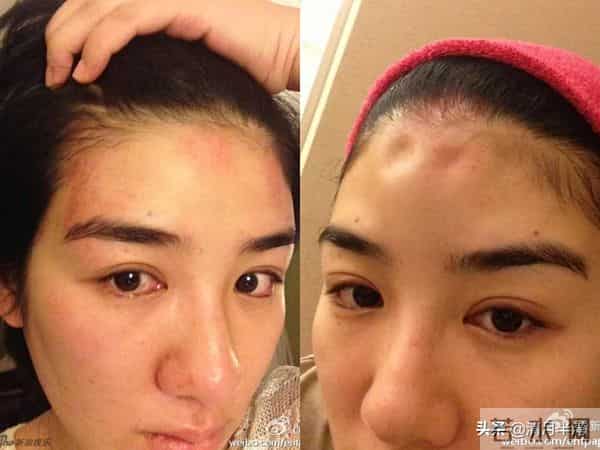 明明已经美得不可一世,却想不开去动脸,这4位女星全是反面案例