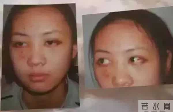 明星家暴：身体只是小伤，心灵受到的伤更难愈合