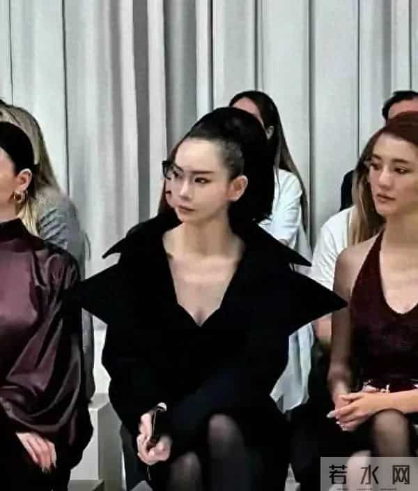 戚薇整个脸做拉皮难道不痛吗？但为了美一切都值得 但发际线有点丑