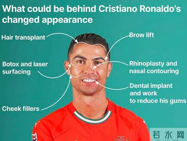 40岁C罗被爆整容,打肉毒杆菌除皱,浓眉不是天生每年600英镑维持
