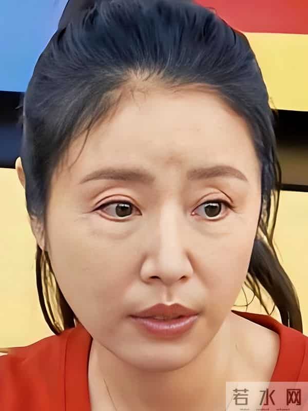 花无百日红!49岁林心如断崖式衰老,紫薇格格也老了,法令纹明显
