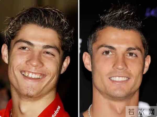 40岁C罗被爆整容,打肉毒杆菌除皱,浓眉不是天生每年600英镑维持