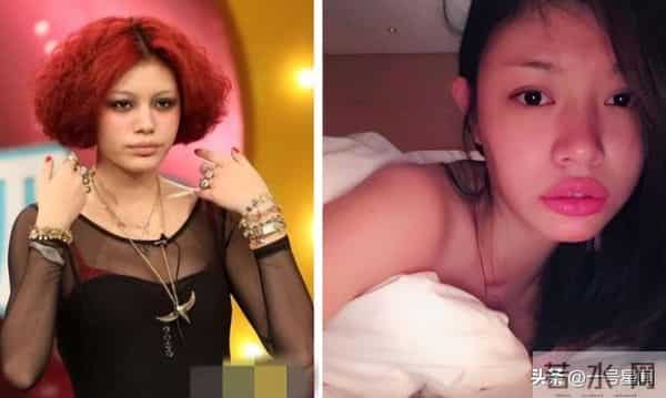 里子面子都丢了,晒出体检报告的森林北,没给汪峰留“体面”