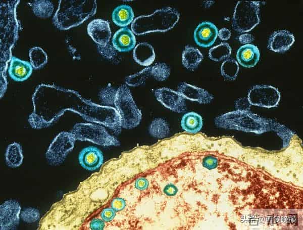 41岁知名女歌手自曝：已确诊！目前无有效治疗手段，这些都是高风险人群