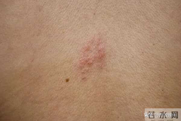 41岁知名女歌手自曝：已确诊！目前无有效治疗手段，这些都是高风险人群