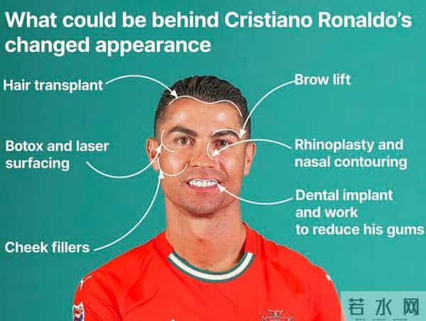 巨星被爆料多次整容，22年内曾经整牙、隆鼻……团队暂无回应