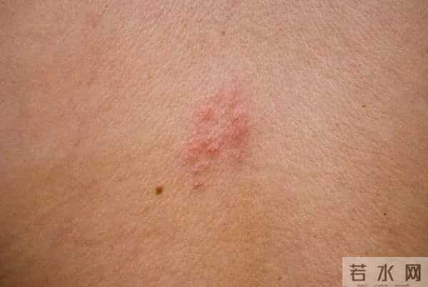 41岁知名女歌手自曝:已确诊!目前无有效治疗手段…这些都是高风险人群→