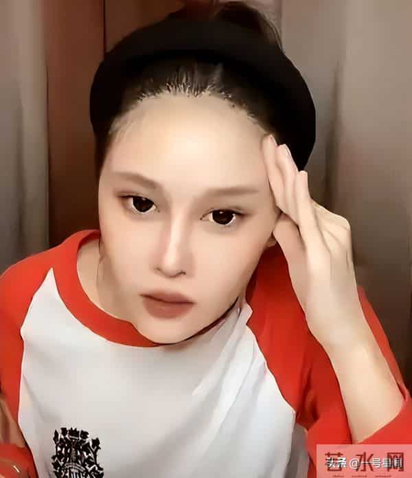 钱再多有什么用?赵本山近况曝光令人吃惊,给老年人敲响"警钟"