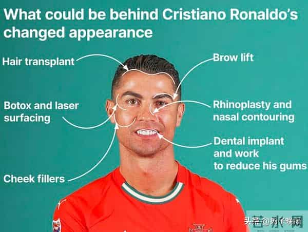 C罗被爆料多次整容,22年内曾经整牙、隆鼻、植发……团队暂无回应