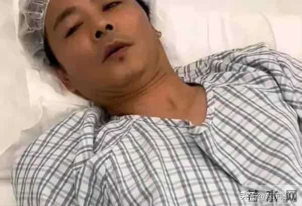 52岁蔡少芬香港逛街，下巴后缩明显，张晋大病痊愈，不能剧烈运动