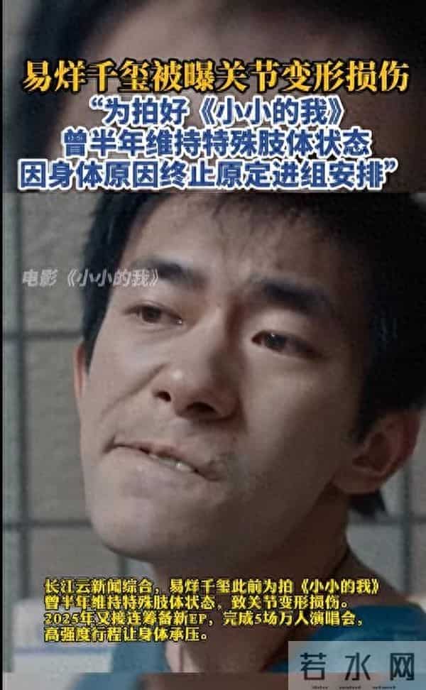 易烊千玺受伤背后,拼命拍戏害了谁?下一部戏还能演吗。