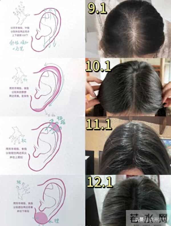 六年“脂脱”油头逆袭记：从“卤蛋”到“海胆”，我只靠揉耳朵？