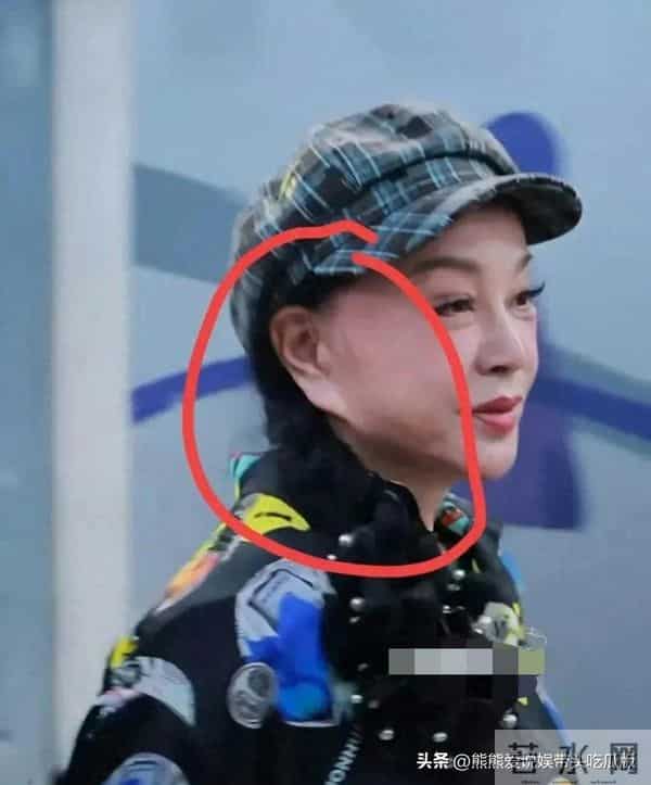 刘晓庆耳垂快与嘴角齐平了,说不出来像什么,看着实在是太怪异了