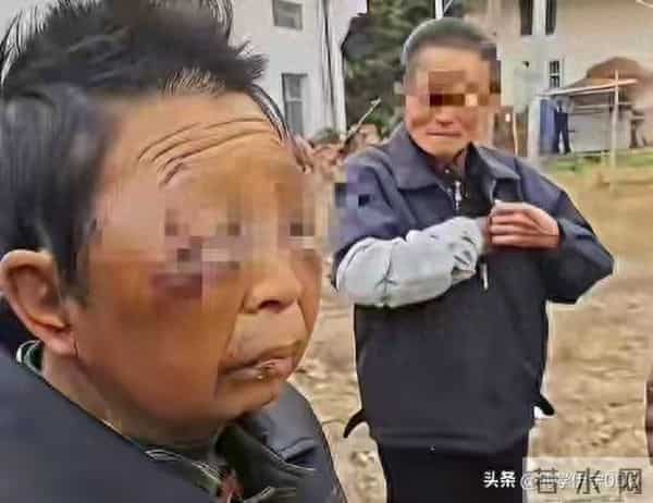 湖南七旬老太遭丈夫两天两度毒打：邻居惊呆，儿子哭诉我没办法！