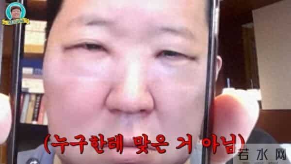 韩男星坦承整形!术后肿到不行「像被暴打」 眼睛惨剩一条缝