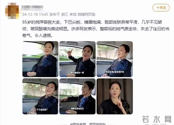 66岁倪萍回应整容传闻,曾卧床3年不动, 如今徒步上山令人羡慕