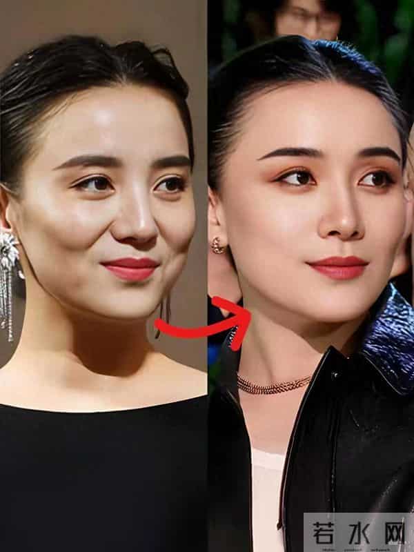 宋佳年轻的时候，和现在差别很大，差点没认出来，岁月饶过谁啊