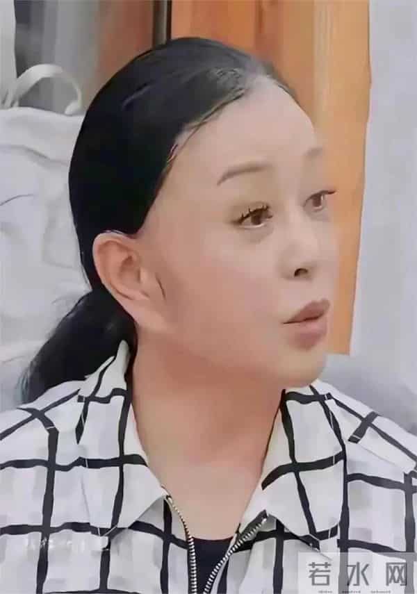 75岁刘晓庆生图流出,头发稀疏快要秃顶,但还是比同龄人显得年轻