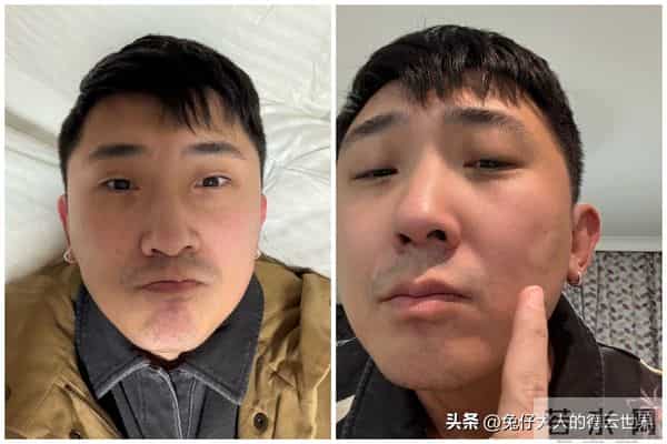 德云社当红演员英国被抢，挨了一拳，脸肿了，好在钱包抢回来了