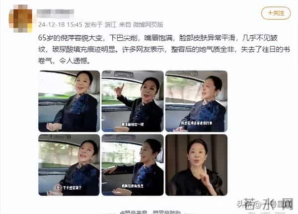 被传整容真相大白4个月，倪萍一句话再次出圈，迟蓬的话有人信了