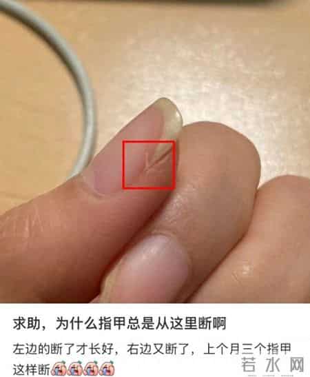 梦到鞋坏了,指甲为什么总从这里断开？是缺钙吗？这些身体信号要注意